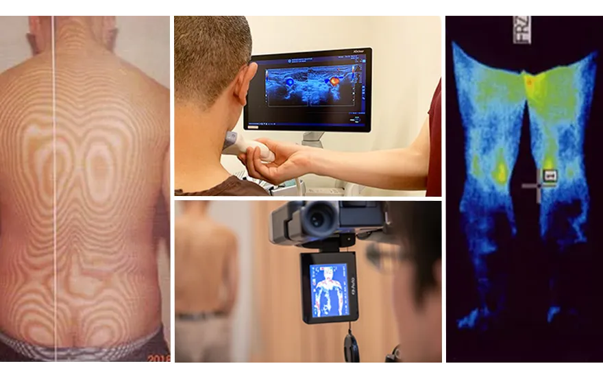 医療用サーモグラフィ、循環器用エコー、モアレトポグラフィ