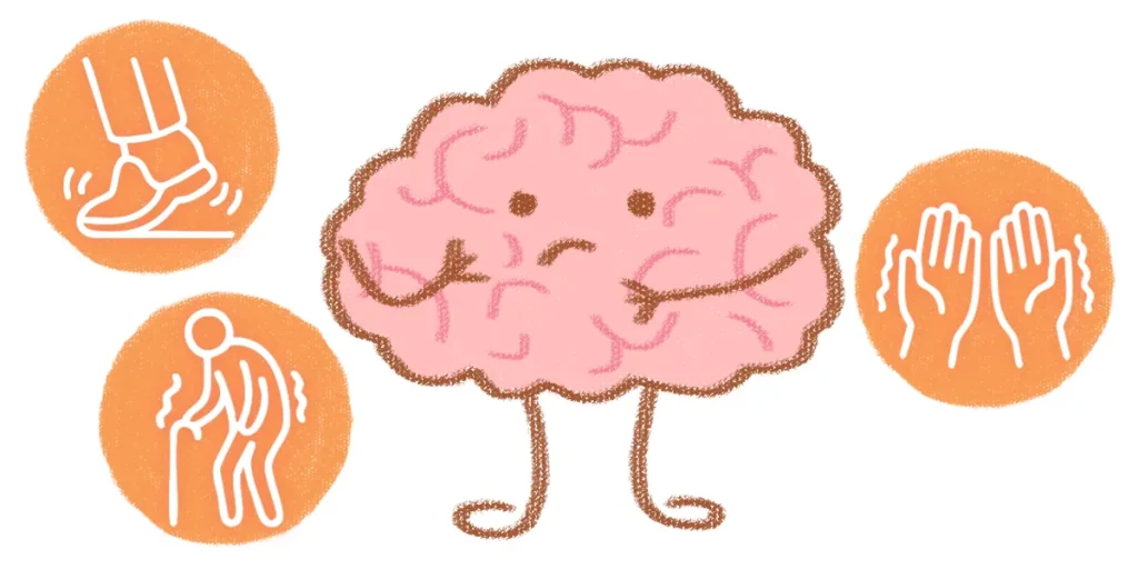 脊髄小脳変性症の多くはパーキンソン症状などが合併して出やすくなる